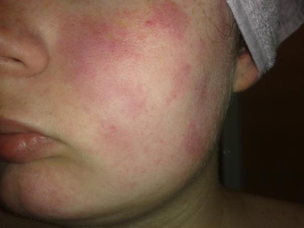 Please help me wash my face!