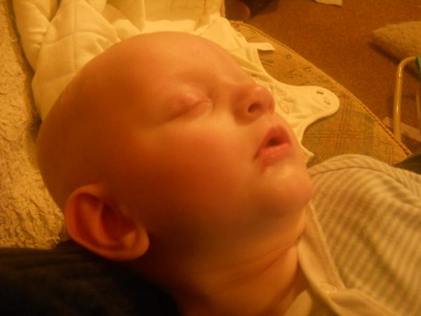 What does this look like (rash on baby's face)