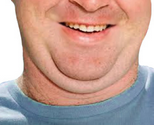 exercises to get rid of double chin please