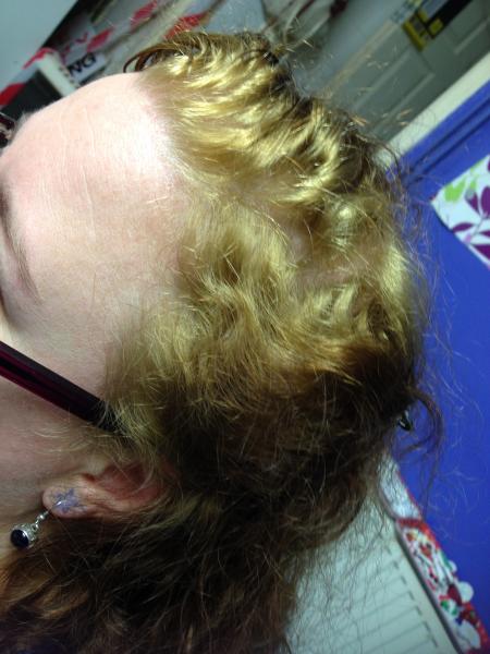 Bleached my hair, now gingery with yellow roots - advice please?