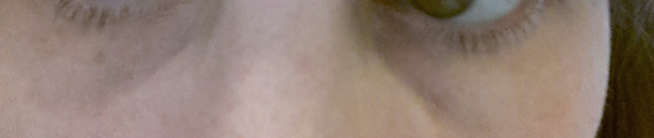 help with dark circles