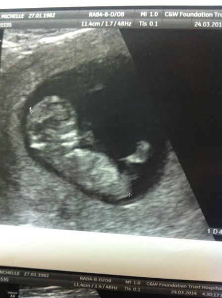 October 2014 - Thread 3... More morning sickness and tired mummy's!