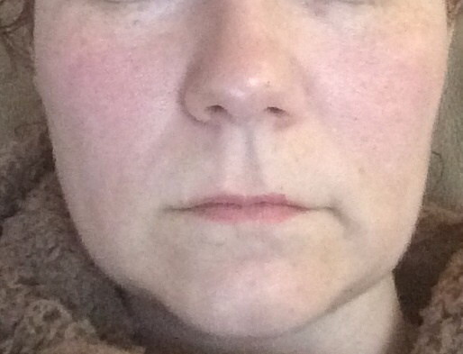 Jowls :(