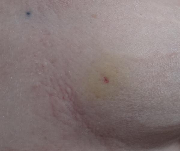 Zombie needs her limbs holding