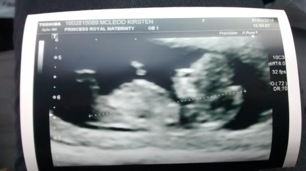 October 2014 - Thread 3... More morning sickness and tired mummy's!