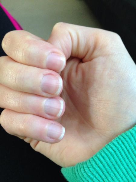 Flaking, splitting fingernails - look a state.  Products?