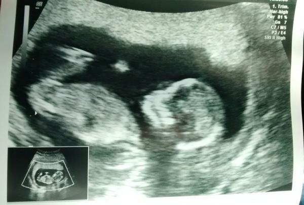 October 2014 - Thread 3... More morning sickness and tired mummy's!