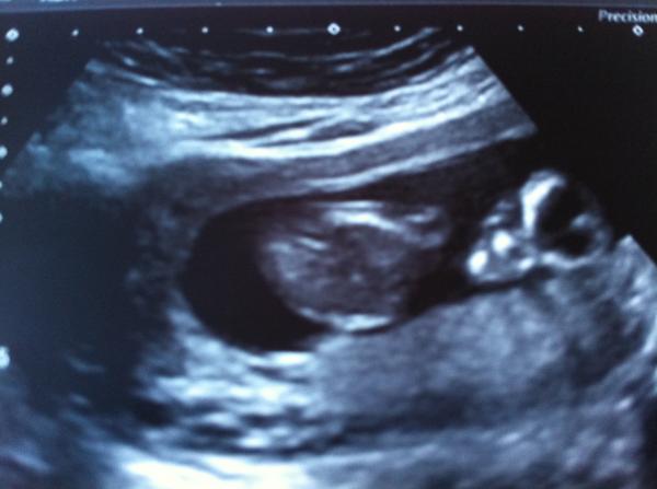 October 2014 - Thread 3... More morning sickness and tired mummy's!