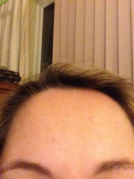 To think Botox