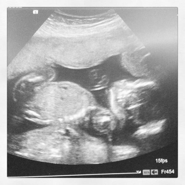 July 2014 - Thread 5: Blooming!