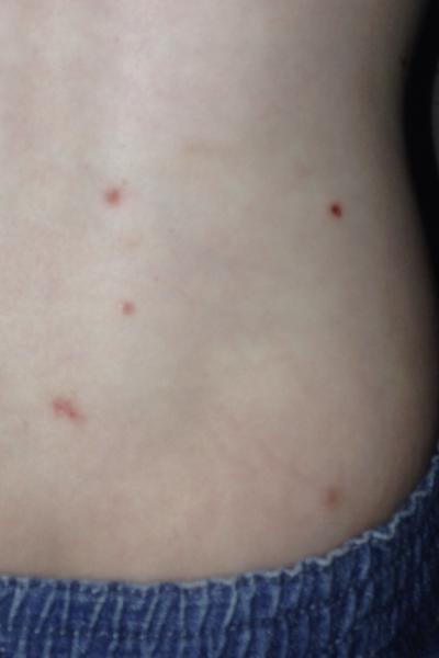 Why is dd covered in spots?