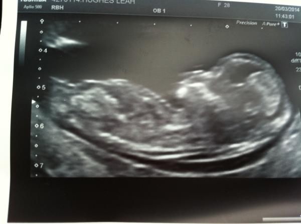 October 2014 - Thread 3... More morning sickness and tired mummy's!