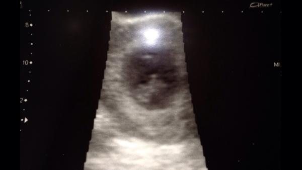 November 2014 - anybody yet?