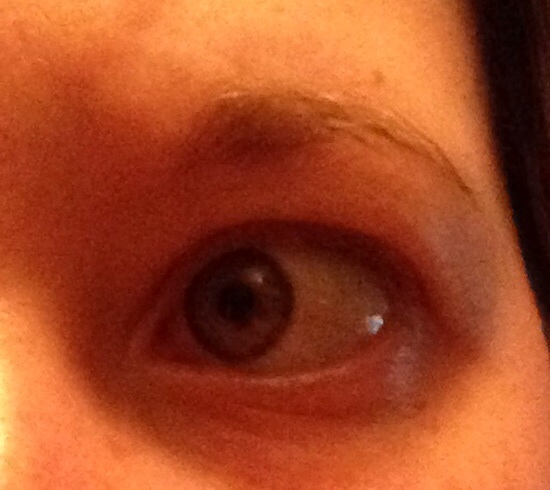 Have I ruined my eyebrows? Is there anything I can do?