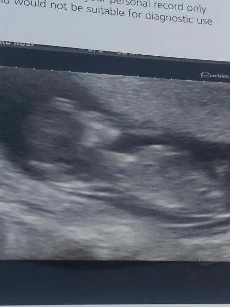 October 2014 - Thread 3... More morning sickness and tired mummy's!