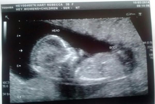 Due 14 September!  ;)