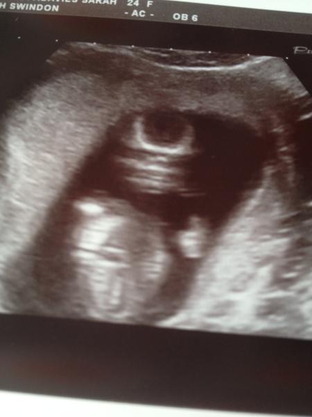 September 2014 - where we enjoy happy scans and a healthy 2nd trimester