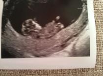 October 2014 - Thread 3... More morning sickness and tired mummy's!