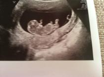 October 2014 - Thread 3... More morning sickness and tired mummy's!