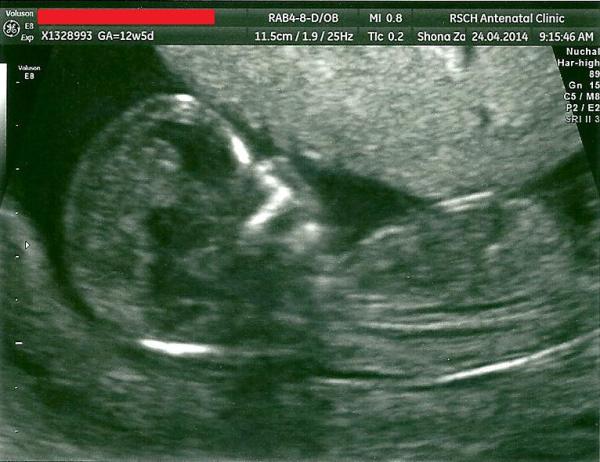 November 2014 Thread 3- Counting towards the second trimester!