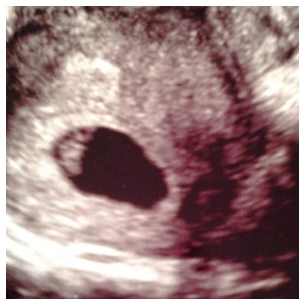 To want some answers?! Pic attached