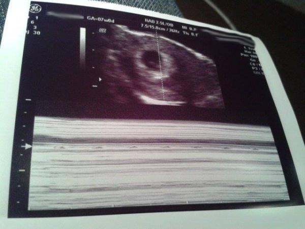 Santa's bringing us a baby! Due December 2014! First time mummies!