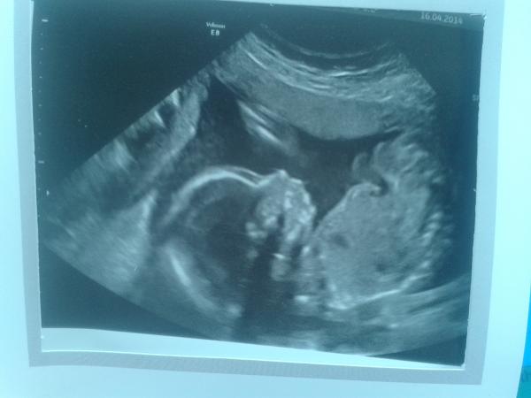 boy or girl guesses please
