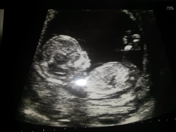 November 2014 Thread 3- Counting towards the second trimester!