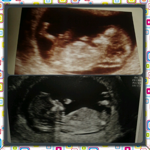 boy or girl guesses please