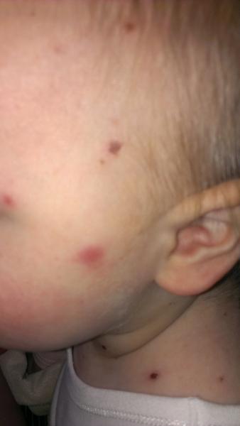 Do you think this scar/mark go away?
