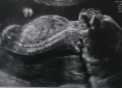 September 2014 - we're over half way there!