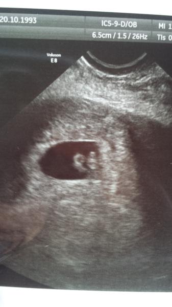 Just Shagging Grads Fred 8! Roll up, roll up, all Viroids welcome!