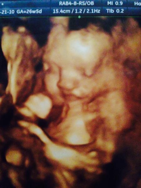 4D scan at noon - what & when to eat/drink so baby me might be awake?