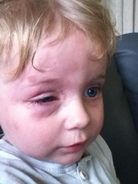 What's your opinion/ experience of nut free schools?