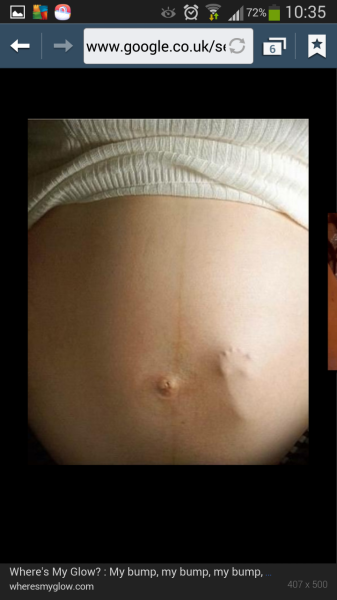 September 2014 - Holding hands and 20 week scans...