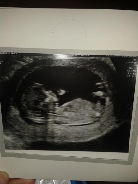 boy or girl guesses please