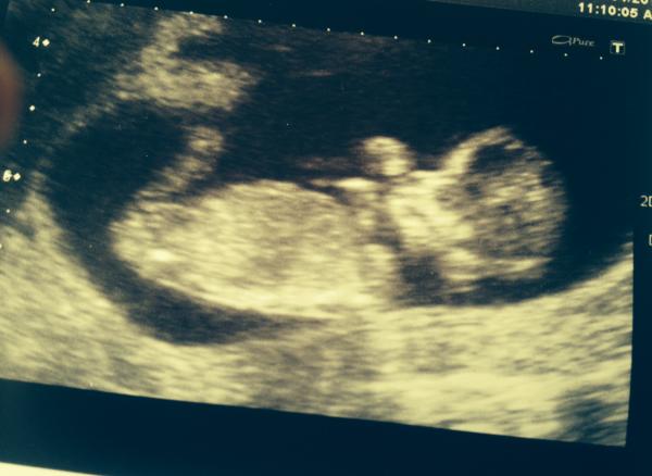 Boy or Girl??