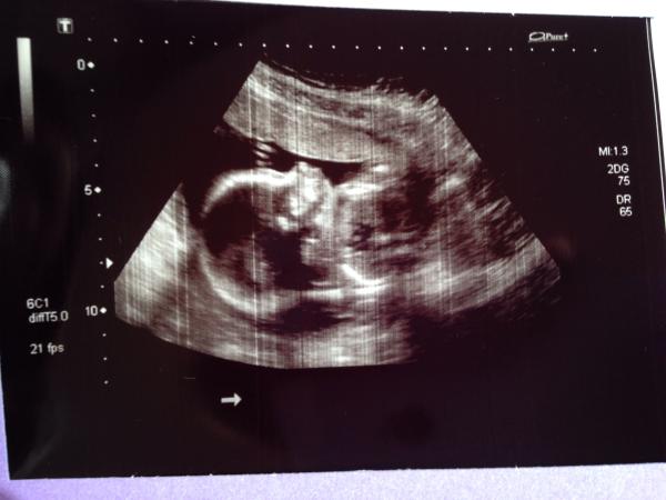 September 2014 - we're over half way there!