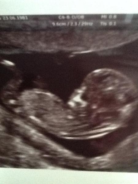 Nub theory boy or girl?!