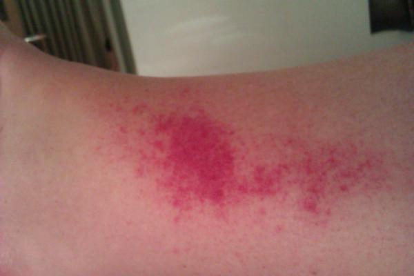 What is going on with my leg?