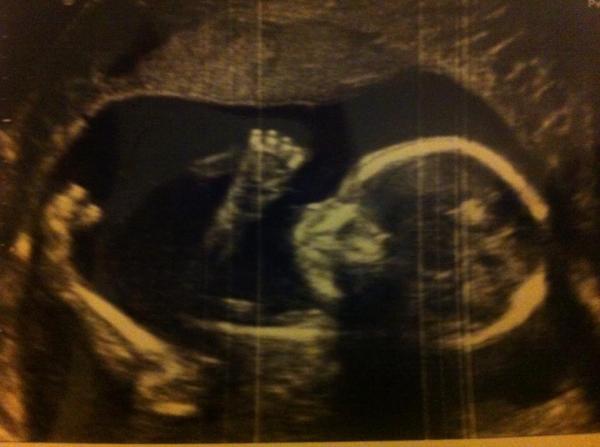 September 2014 - we're over half way there!