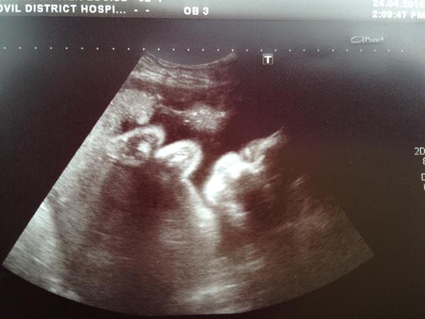 July 2014 - Here comes the 3rd trimester, hold on to your knickers! Thread 6