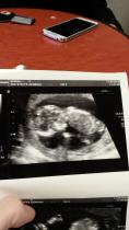 hiya I had my 13 week scan today?