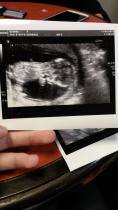 hiya I had my 13 week scan today?