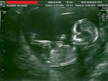 November 2014 Thread 3- Counting towards the second trimester!