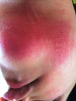 What's your opinion/ experience of nut free schools?