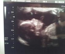 September 2014 - Holding hands and 20 week scans...