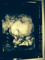 July 2014 - Thread 5: Blooming!