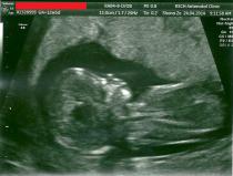 November 2014 Thread 3- Counting towards the second trimester!