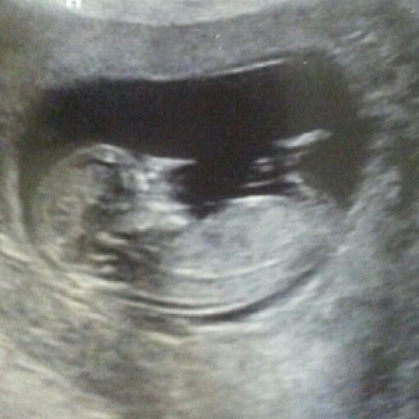 December 2014, Thread #3